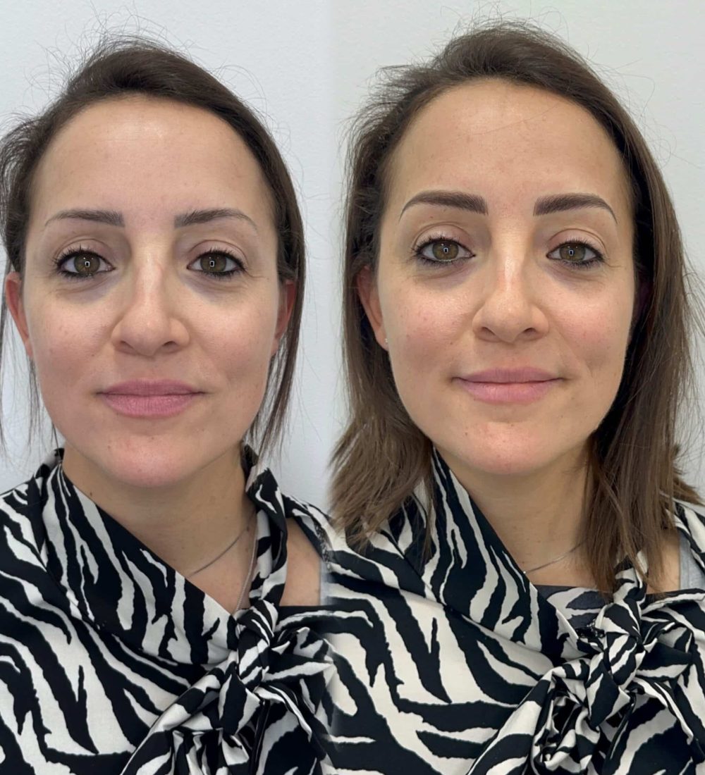 COVER UP MICROBLADING COVER UP MICROBLADING