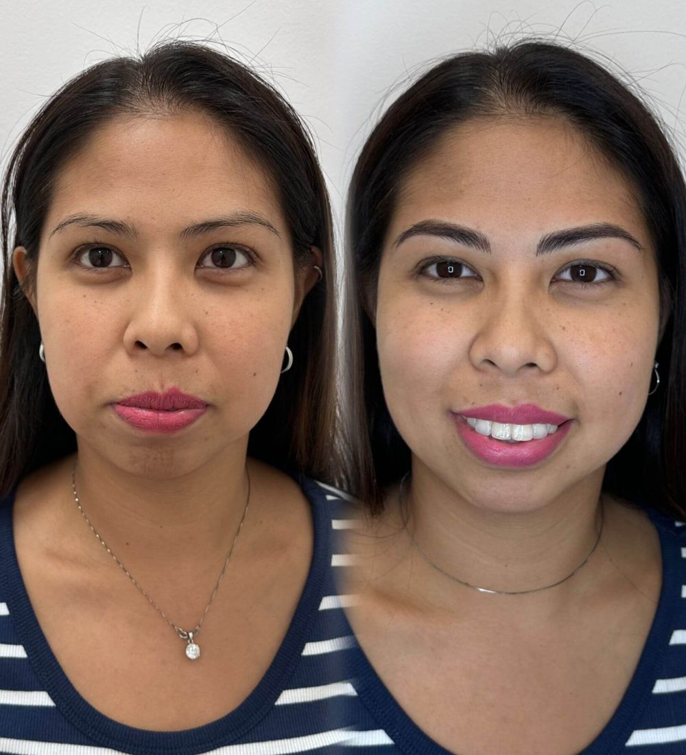 Microblading Roma 2025 Microblading Roma 2025